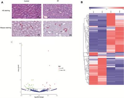 Identification of an unrecognized circRNA associated with development of renal fibrosis